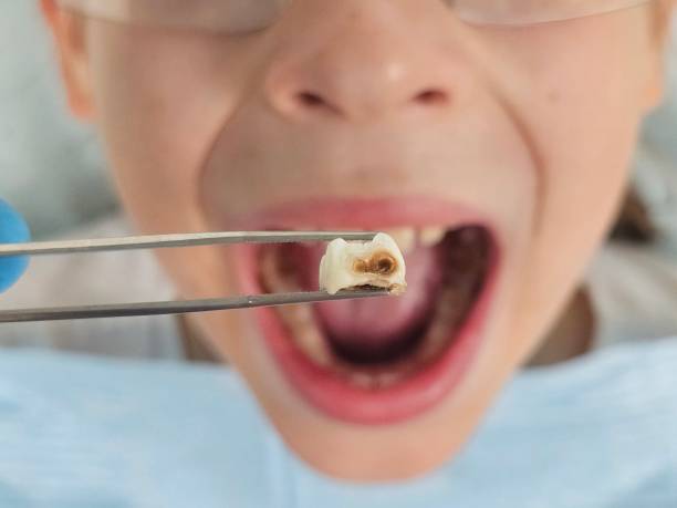 Best Emergency Pediatric Dental Care in Ridgefield, WA